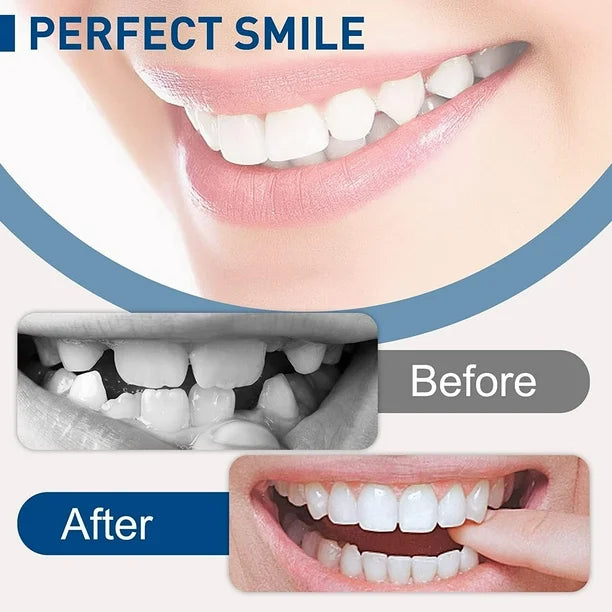 CARILLAS DENTALES IM